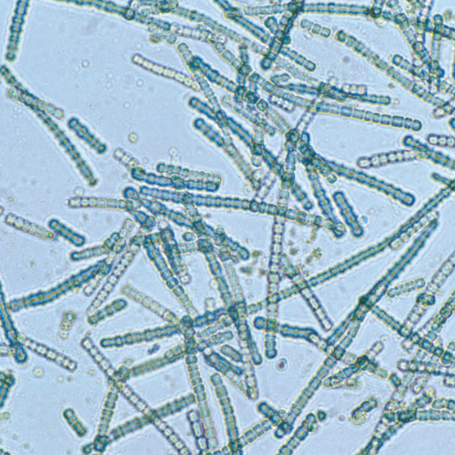 A bluegreen algae species Cylindrospermum sp under magnification