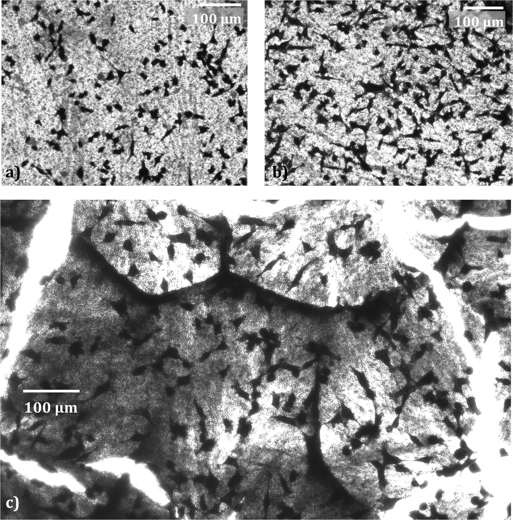  Fibrosarcoma cells on a) an empty template b) a template filled with PLLA nanowires andd c) PLLA nanowires after the template has been removed