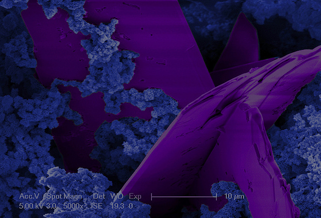 D. G. Strange- 'Crystal Tower' Photo from Flickr under a CC-BY-NC-ND license. https://www.flickr.com/photos/cambridgeuniversity-engineering/5201629392/
This photo shows a formation of brushite crystals resting on a bed of hydroxyapatite, observed under scanning electron microscopy.