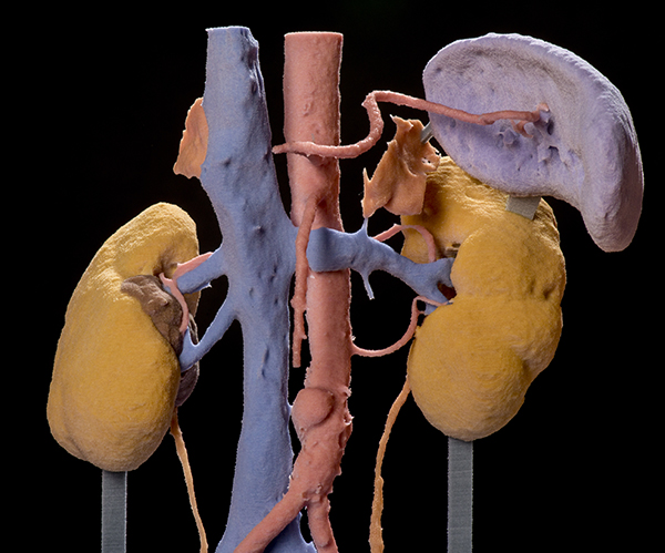 Announcing CamMed 3D group- exciting new ventures in all things 3D printing