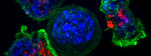 Flouresence microscopy image of a cancer cell surrounded by killer T cells, illustrating how CAR-T therapies work. Image courtesy of the NIH Image library.