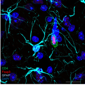 Microscopy image of brain-resident regulatory T cells